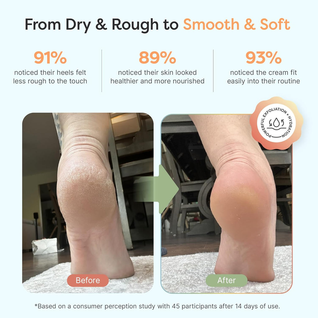 ZenToes Urea Cream 40 Percent for Feet | Foot Lotion for Dry Cracked Heels and Feet | Intense Dry Feet Softening and Hydration for Skin | Heel Balm and Moisturizing Care | 5oz