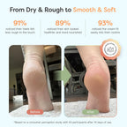 ZenToes Urea Cream 40 Percent for Feet | Foot Lotion for Dry Cracked Heels and Feet | Intense Dry Feet Softening and Hydration for Skin | Heel Balm and Moisturizing Care | 5oz