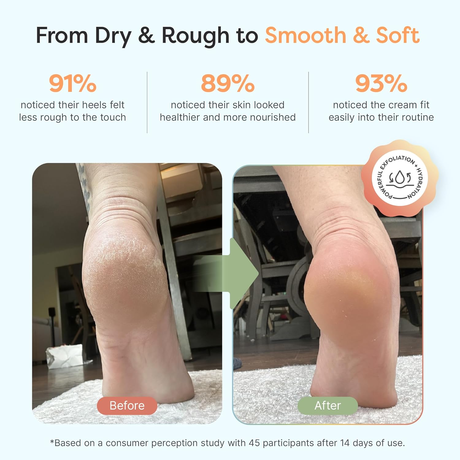 ZenToes Urea Cream 40 Percent for Feet | Foot Lotion for Dry Cracked Heels and Feet | Intense Dry Feet Softening and Hydration for Skin | Heel Balm and Moisturizing Care | 5oz