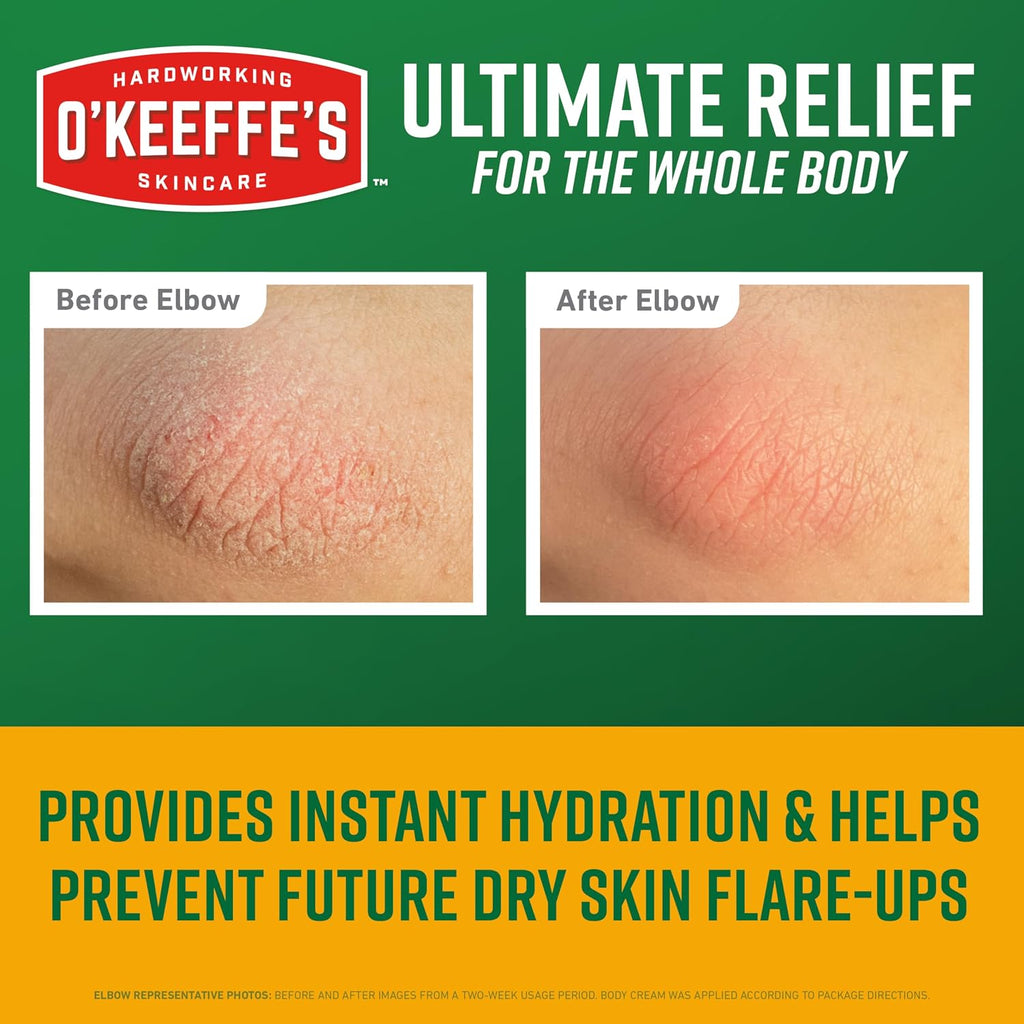 O’Keeffe’S Skin Repair Ultimate Relief Body Cream, 7Oz Tube (Pack Of 1) – For The Most Severe Dry Skin