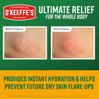 O’Keeffe’S Skin Repair Ultimate Relief Body Cream, 7Oz Tube (Pack Of 1) – For The Most Severe Dry Skin