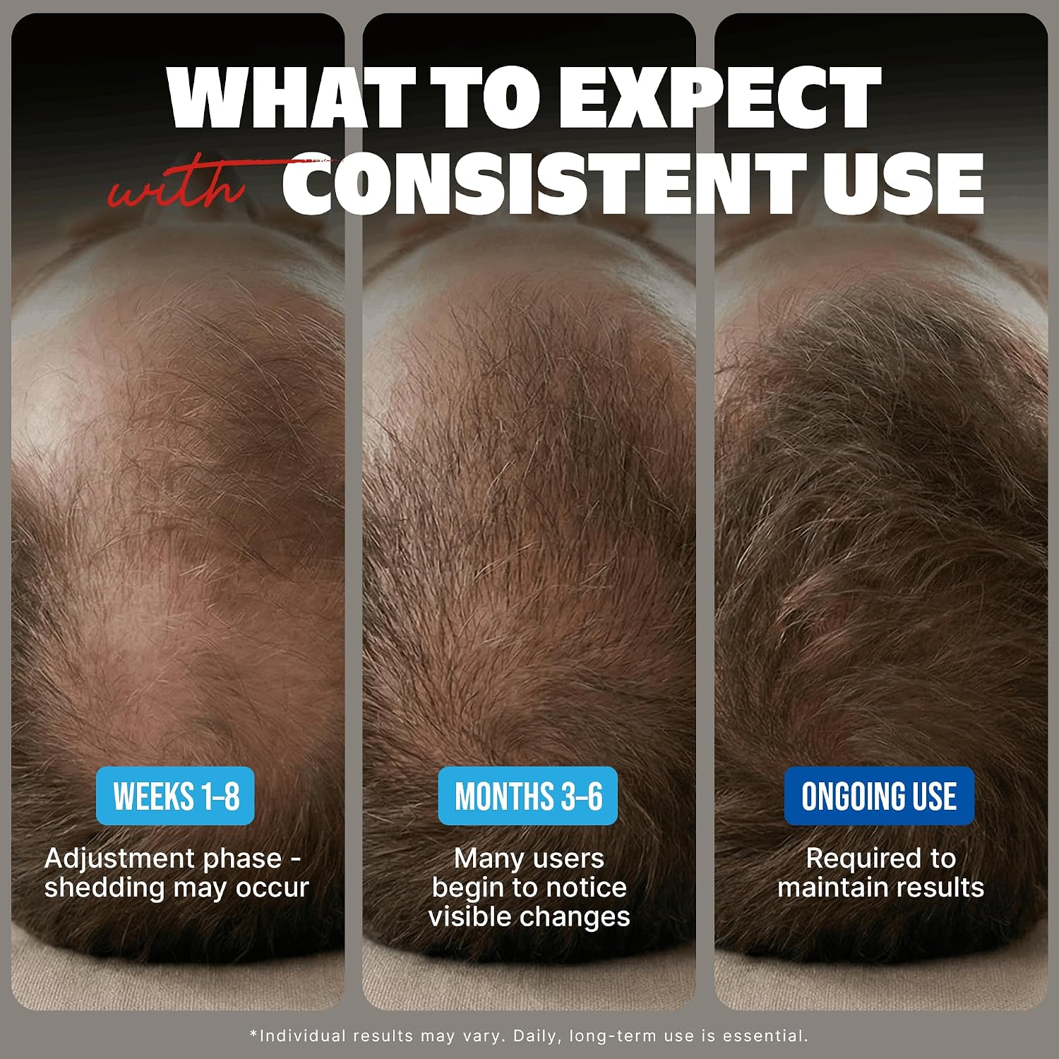 Minoxidil Liquid Extra Strength Hair Regrowth Treatment For Men, 5% Topical Solution, 6 Months Supply - Dropper Applicator And Bonus Free Instructional Guide Included
