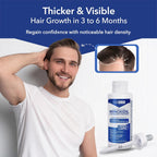 Hair Regen Liquid Minoxidil for Men 5% – Advanced Topical Solution for Regrowth – Growth Treatment for Men Hair Loss 6-Pack as 6-Month Supply Kit