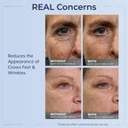 Plexaderm Rapid Reduction Eye Serum - Visibly Reduces Under-Eye Bags, Wrinkles, Dark Circles, Fine Lines & Crow'S Feet Instantly, Anti Aging Wrinkle Remover For Face, Pump