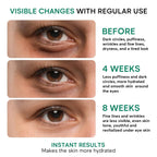 Under Eye Cream For Dark Circles And Puffiness - Anti-Aging Caffeine Eye Cream Serum For Wrinkles With Retinol, Collagen, Peptides & Niacinamide - Mature & Older Skin - 1.85 Oz