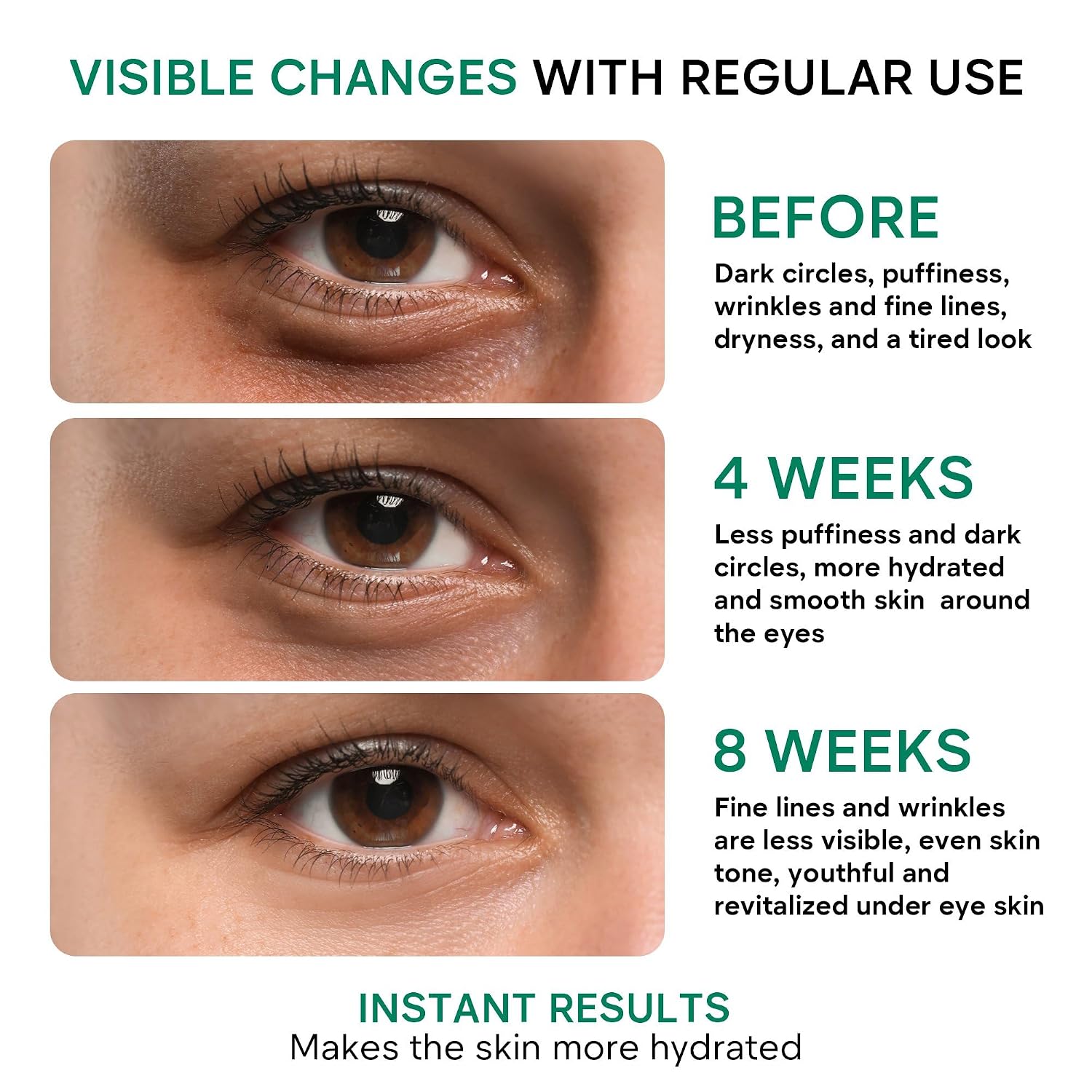 Under Eye Cream For Dark Circles And Puffiness - Anti-Aging Caffeine Eye Cream Serum For Wrinkles With Retinol, Collagen, Peptides & Niacinamide - Mature & Older Skin - 1.85 Oz