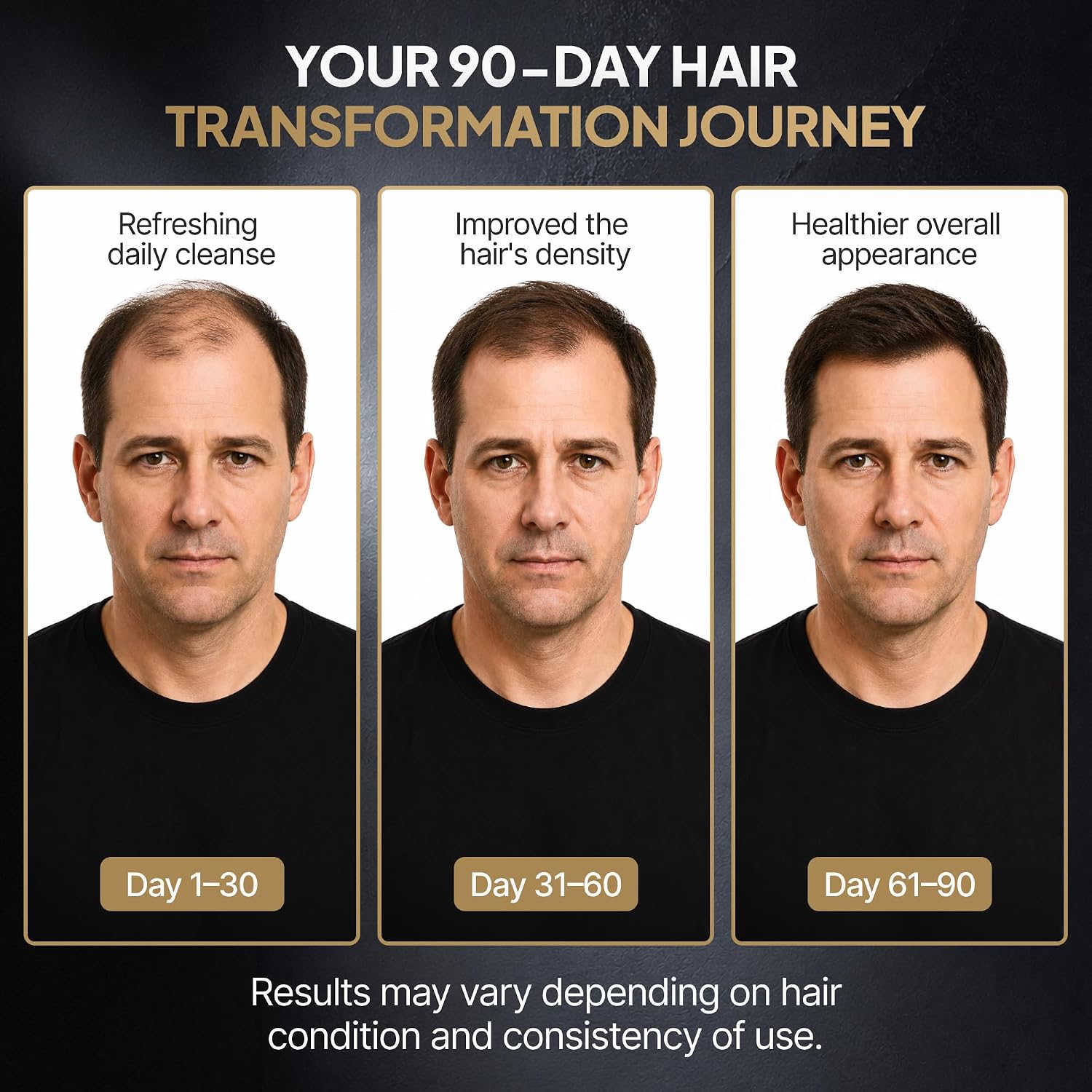 Spartan™ Root Activator Shampoo For Men - Hair Growth Shampoo For Hair Loss And Thinning Hair