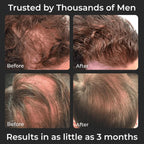 SPARTAN™ Root Activator Shampoo For Men - Hair Growth Shampoo for Hair Loss and Thinning Hair