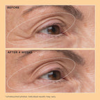 Perricone Md Neuropeptide Eyelid Lift Serum, 0.5 Fl Oz.