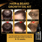 Beaueli Minoxidil Beard Growth Kit For Men And Women, Hair Loss And Hair Regrowth Treatments, Minoxidil 5%, Black