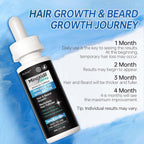5% Minoxidil for Men, Minoxidil for Women Hair Growth Treatment, Beard Growth Serum, Biotin & Castor Oil Enriched,Strengthens Weak Roots, Repairs Thinning Hair (120ml)
