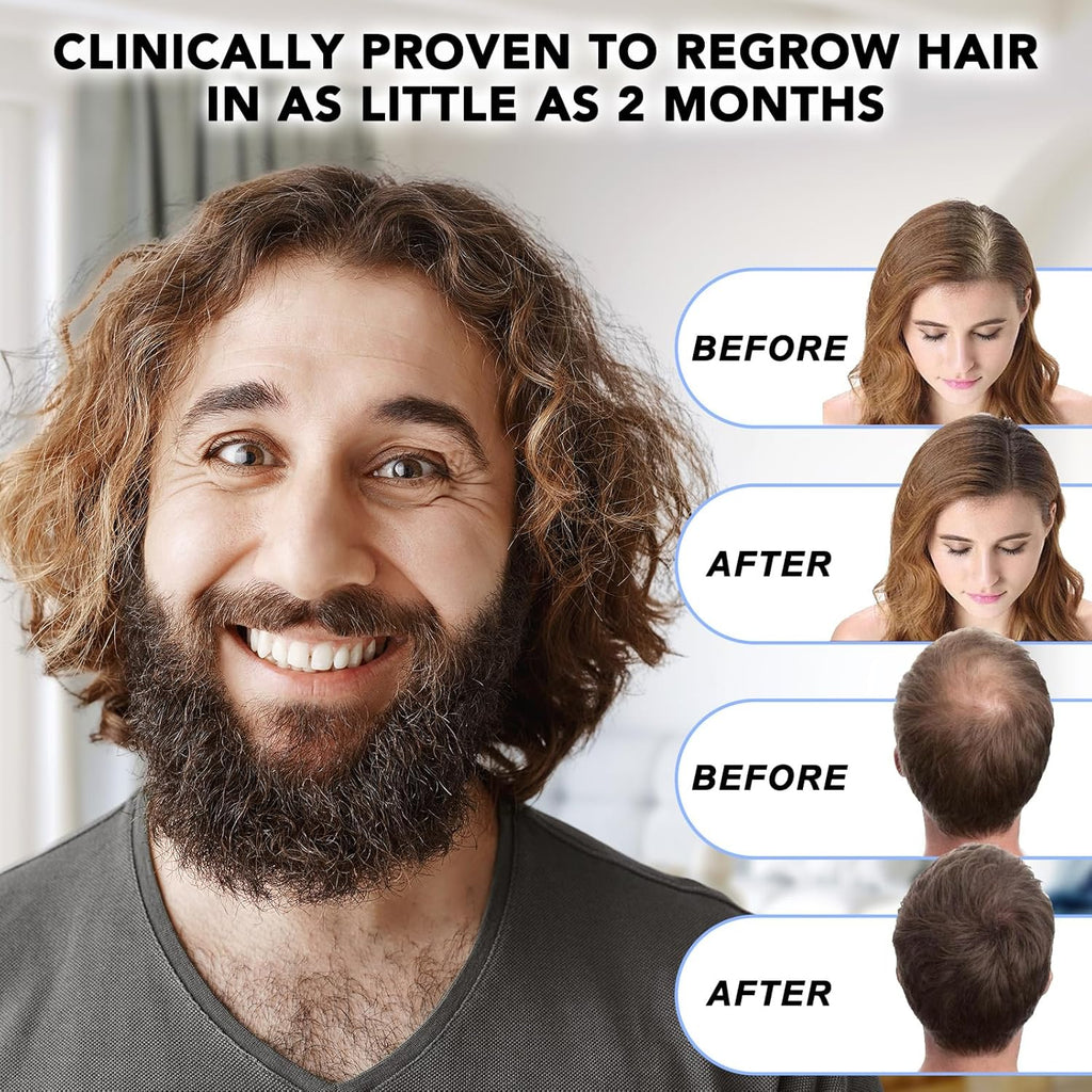 Minoxidil for Men-5% Extra Strength Hair Regrowth for Men Treatment-5% Topical Solution-Dropper Applicator Included -Minoxidil for Women-Stop Thinning & Hair Loss (1)