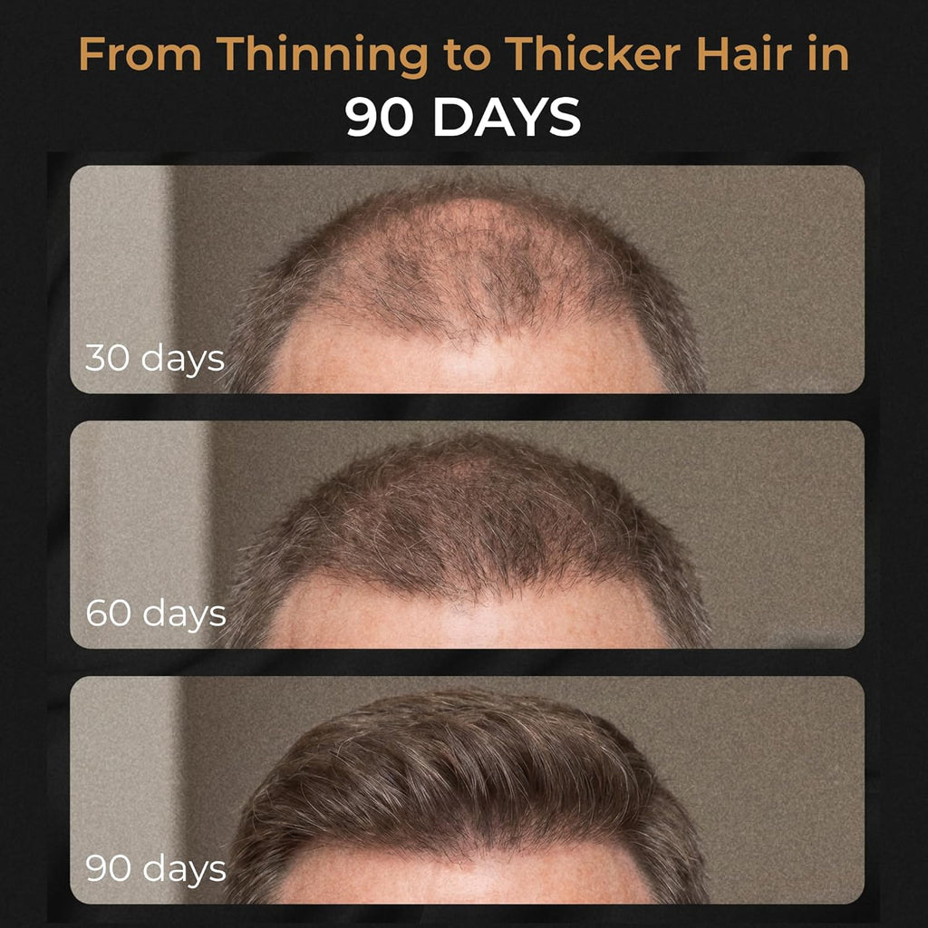 SPARTAN™ Root Activator Shampoo For Men - Hair Growth Shampoo for Hair Loss and Thinning Hair