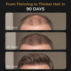 SPARTAN™ Root Activator Shampoo For Men - Hair Growth Shampoo for Hair Loss and Thinning Hair