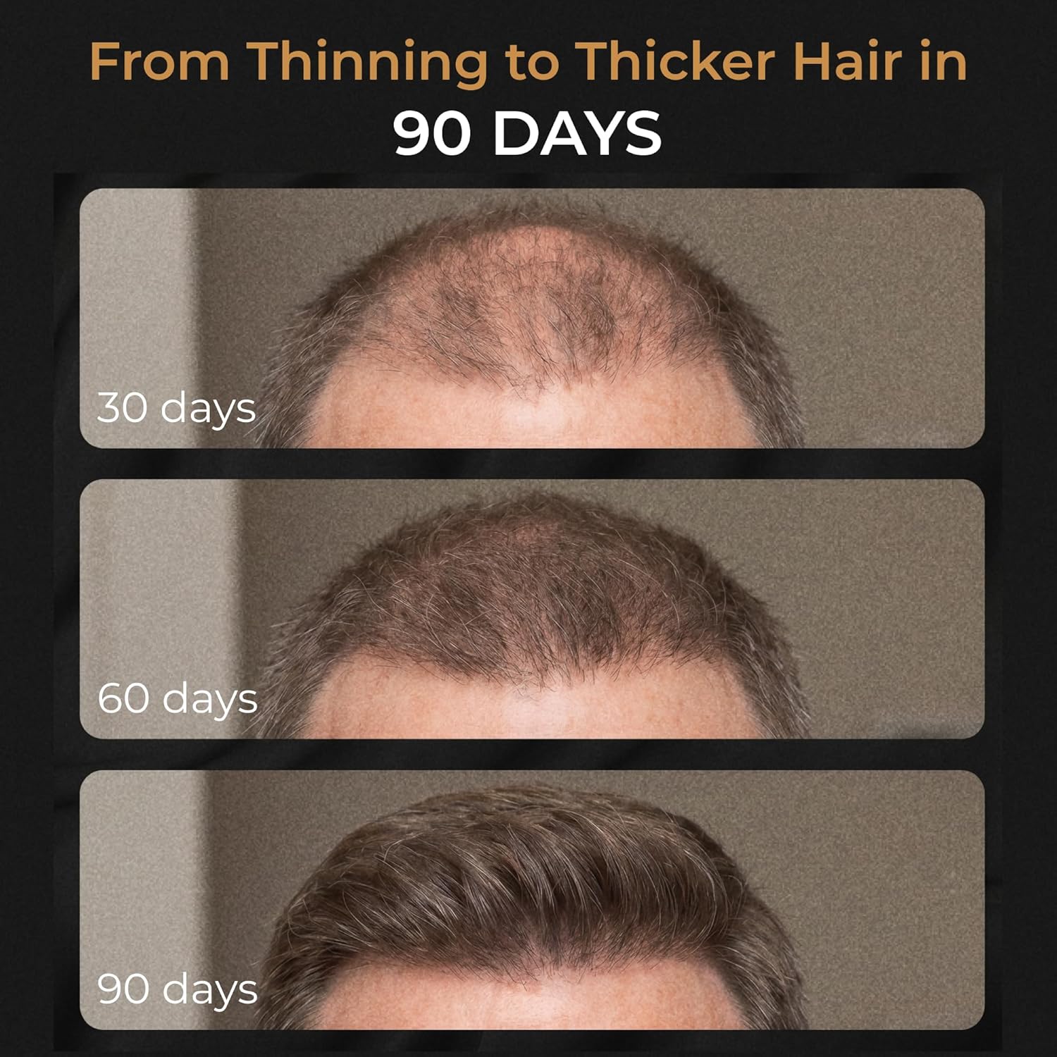 SPARTAN™ Root Activator Shampoo For Men - Hair Growth Shampoo for Hair Loss and Thinning Hair