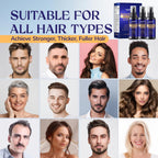 5% Minoxidil Hair Growth for Men and Women: 3-Pack RootStim Extra Strength Minoxidil Beard Regrowth Treatment with Rosemary for Thinning Hair Regrowth and Fuller Hair 180 ML