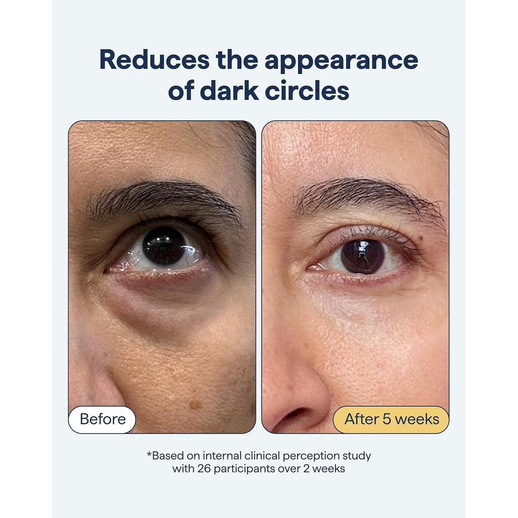 Remedy Dark Circles Reducing Advanced Eye Cream | Undereye Discoloration Treatment | Caffeine, Kojic Acid, Niacinamide, Marine Algae Complex | By Dermatologist Dr. Shah, 0.5 Fl. Oz