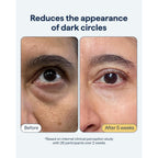 Remedy Dark Circles Reducing Advanced Eye Cream | Undereye Discoloration Treatment | Caffeine, Kojic Acid, Niacinamide, Marine Algae Complex | By Dermatologist Dr. Shah, 0.5 Fl. Oz