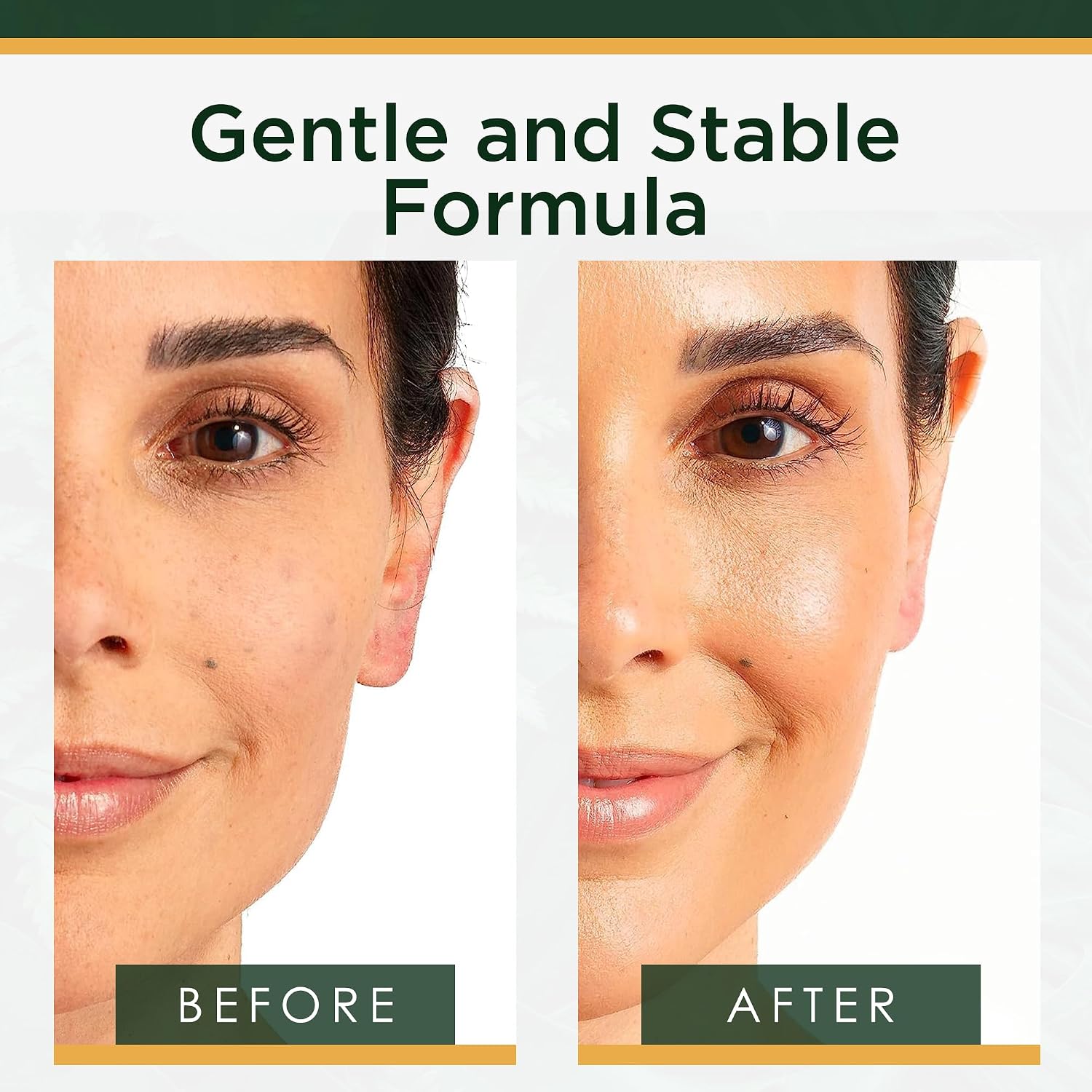 Anti-Aging Eye Treatment Gel Cream To Hydrate Dark Circles And Reduce Puffiness, Bags And Wrinkles, Luxe Eyebright Gel With Amino Acids