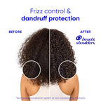 Head & Shoulders Anti-Dandruff Shampoo And Conditioner With 1% Pyrithione Zinc, Smooth & Silky 2 In 1, 24-Hour Frizz Control, Soothes Dry & Itchy Scalp, Leaves Hair Healthy, Shiny & Smooth, 28.2 Fl Oz