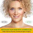 Elbbub Premium Vitamin E Oil - Ultra Concentrated - Moisturizes, Improves Appearance Of Scars & Stretch Marks, Skin Hydration - For Face, Body, Hair, And Nails