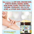 Botanical Beauty Elderberry Seed Oil Butter 100% Natural Pure Virgin Unrefined Raw For Face, Skin, Body, Hair, Nails, Dry Skin. Elderberry Oil, Coconut Butter, Vitamin E