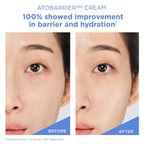 Aestura Atobarrier365 Cream With Ceramides, Korean Face Moisturizer For Barrier Repair | 120H Lasting Hydration, Ceramide Capsules, Dry & Sensitive Skin, Non-Comedogenic, 80 Ml / 2.70 Fl.Oz.