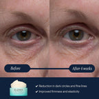 Elemis Pro-Collagen Vitality Eye Cream 15Ml, Restorative Eye Cream To Firm, Replenish & Smooth Skin