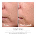Epionce Renewal Facial Lotion - Hydrating, Anti-Aging Moisturizer For Normal To Combination Skin, For Fine Lines & Wrinkles, Dermatologist Skincare