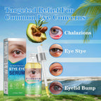 Stye Relief Serum & Eyelid Drops For Blepharitis & Chalazion | Natural Fast-Acting Formula For Lash Line & Under Eye | Gentle Cleansing Care 1.01 Fl Oz (Pack Of 1)