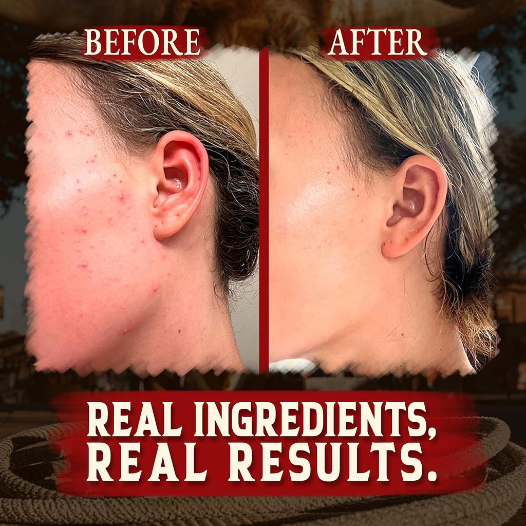 Organic Beef Tallow For Skin - 4 Oz (Unscented) — Us-Made Grass Fed Beef Tallow For Face + Body — Whipped Tallow And Honey Balm Moisturizer For Dry And Sensitive Skin, Eczema, Rosacea (No Additives)