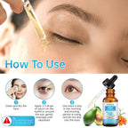 Eye Serum For Chalazion & Blepharitis, 30Ml Chalazion Remover For Eyelid, Blepharitis Eyelid Serum With Avocado Oil, Sea Buckthorn Oil & Caffeine, Relieve Puffiness And Eye Fatigue