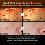 Dr. Melaxin Peel Shot Kojic Acid Turmeric Serum – Exfoliating Dark Spot Corrector With Aha/Bha & Niacinamide, Brightening & Even Tone Facial Serum (80Ml / 2.70 Fl Oz)