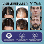 5% Minoxidil For Men And Women Hair Growth Kit: Minoxidil Spray Hair Regrowth Treatment Serum With Biotin & Rosemary -Stop Hair Thinning And Hair Loss For Stronger Thicker Longer Hair 2 Pack