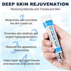 Azelaic Acid 10% Cream For Face - Acne Cream For Rosacea Reducing Relief Pimple Breakouts Blackhead Pigmentation And Redness - Azelaic Acid Gel For Facial And Skin Care