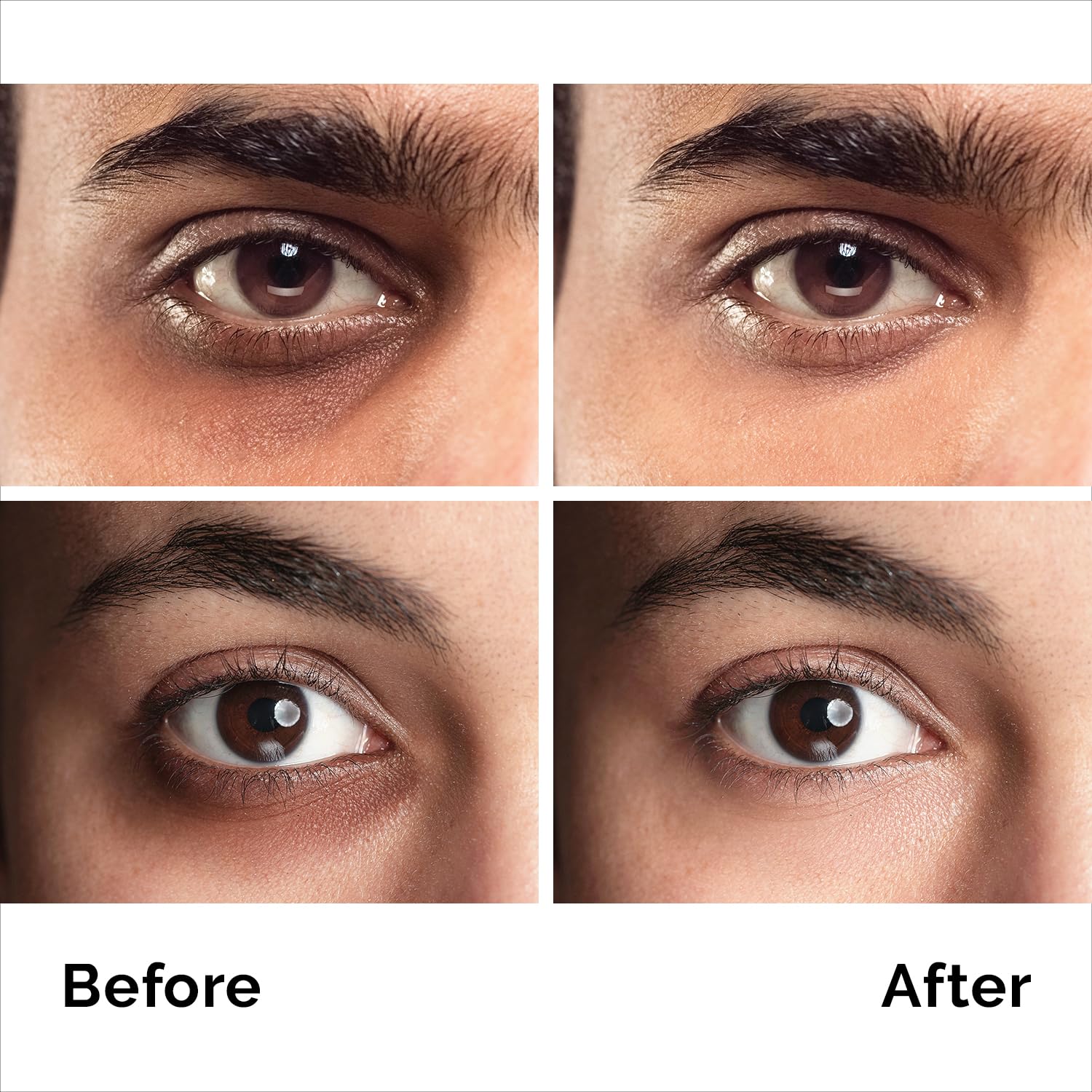 Pure Research Caffeine Eye Cream For Anti Aging, Dark Circles, Bags, Puffiness. Great Under Eye Skin + Face Tightening, Eye Lift Treatment For Men & Women 1.7Oz