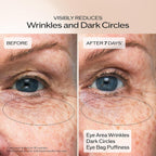 Shiseido Benefiance Wrinkle Smoothing Eye Cream - 15 Ml - Visibly Improves Five Types Of Eye Wrinkles, Dark Circles & Puffiness - 48-Hr Hydration - All Skin Types - Non-Comedogenic