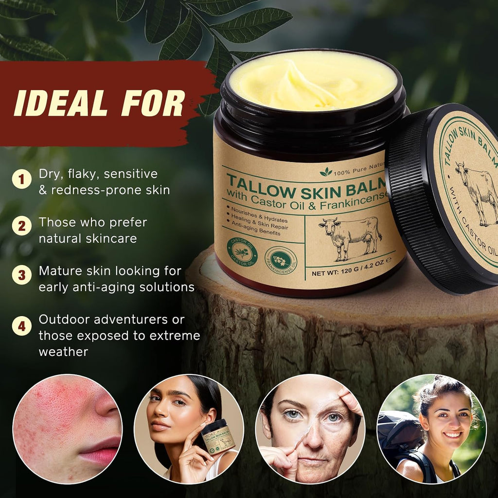 Beef Tallow For Skin & Face Cream With Castor Oil And Frankincense,120G,Organic Natural 100% Grass Fed,Whipped Beef Tallow Balm Deeply Moisturizing For Face & Body Care,4.2 Oz