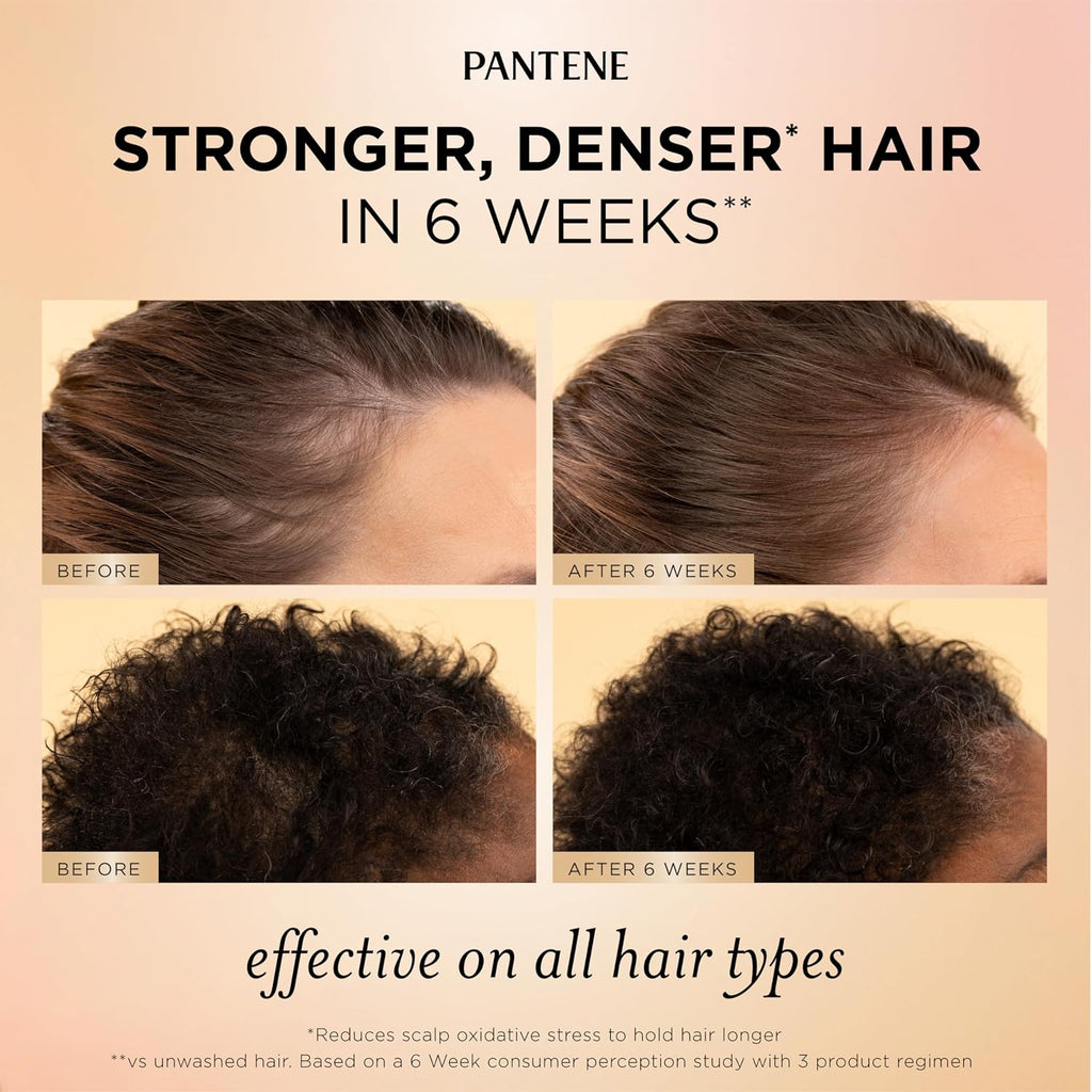 Pantene Abundant & Strong 3-Piece Regimen With B5 Complex + Niacinamide, Shampoo (13.5 Oz), Conditioner (8 Oz), Serum (2 Oz) For Hair Loss, Thinning, Anti-Breakage, Volume - Grows Healthier