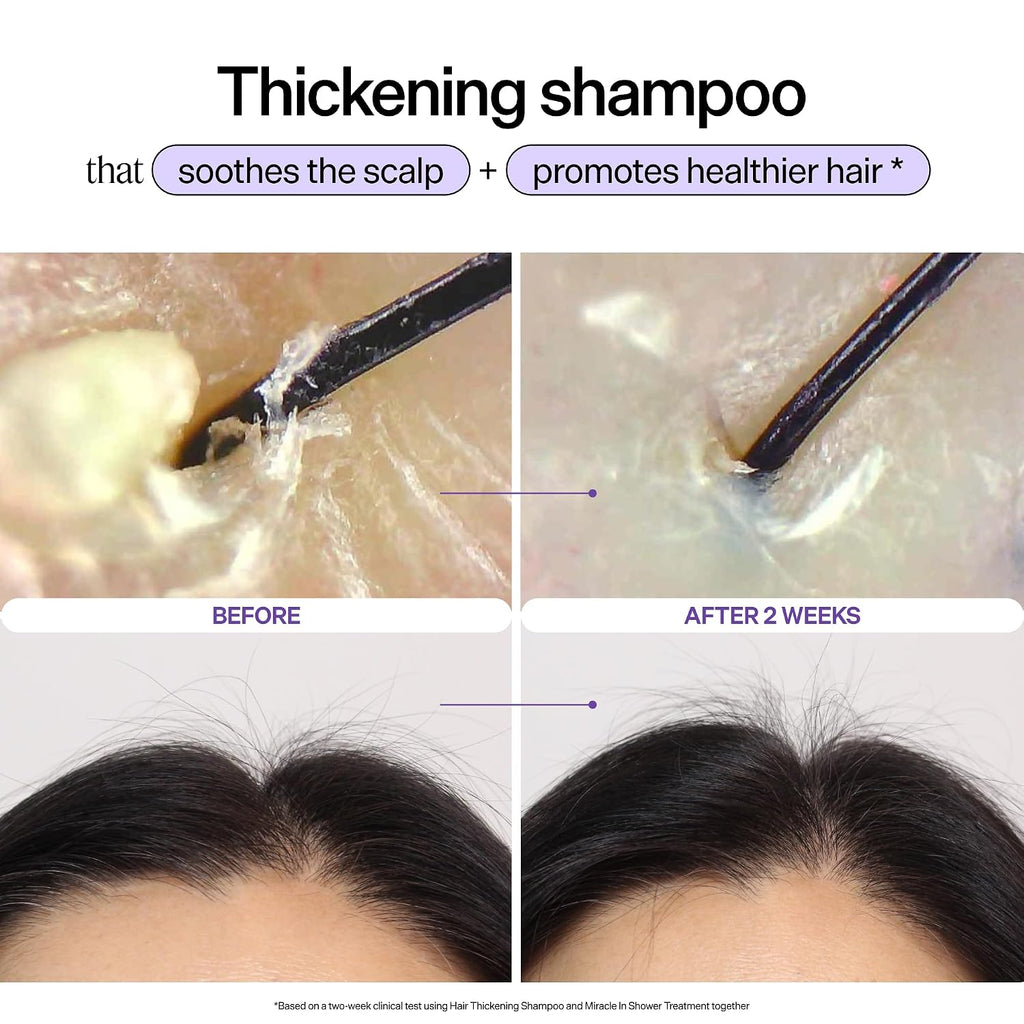 Dr. Groot Hair Thickening Shampoo, Korean Hair Care With Biotin, Rosemary Oil To Help Volumize Thinning, Damaged Hair, Hydrate Hair And Scalp, Biotin Shampoo, Scalp Revitalizing Solution