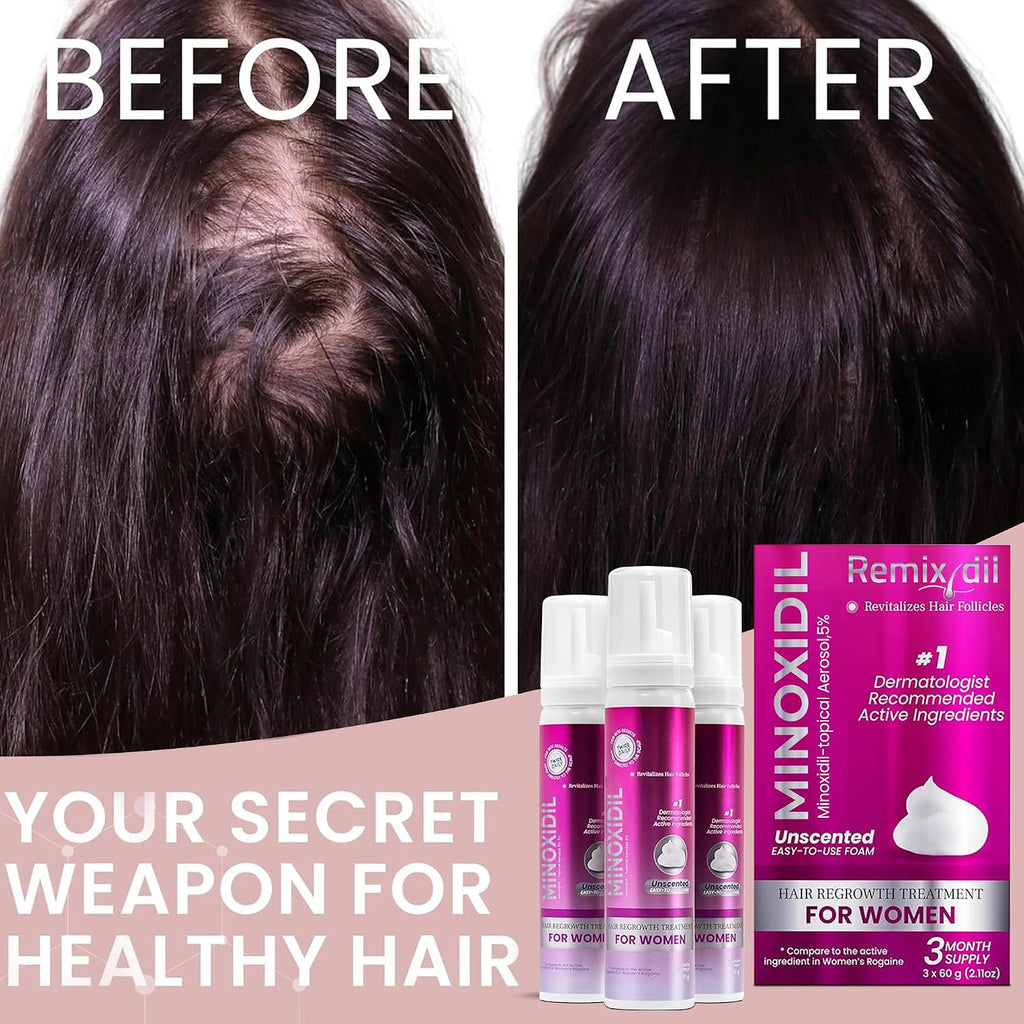 Minoxidil For Women | 5% Minoxidil For Women Hair Growth | Hair Regrowth Treatment | Unscented Topical Foam | Dermatologist Recommended | Clinically Proven Formula | 3 Month Supply
