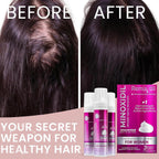 Minoxidil For Women | 5% Minoxidil For Women Hair Growth | Hair Regrowth Treatment | Unscented Topical Foam | Dermatologist Recommended | Clinically Proven Formula | 3 Month Supply