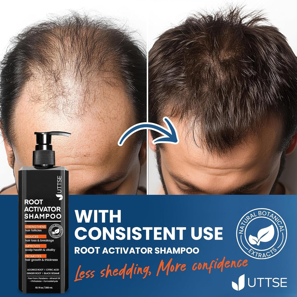 Root Activator Shampoo for Men: Hair Growth Shampoo for Hair Loss and Thinning Hair