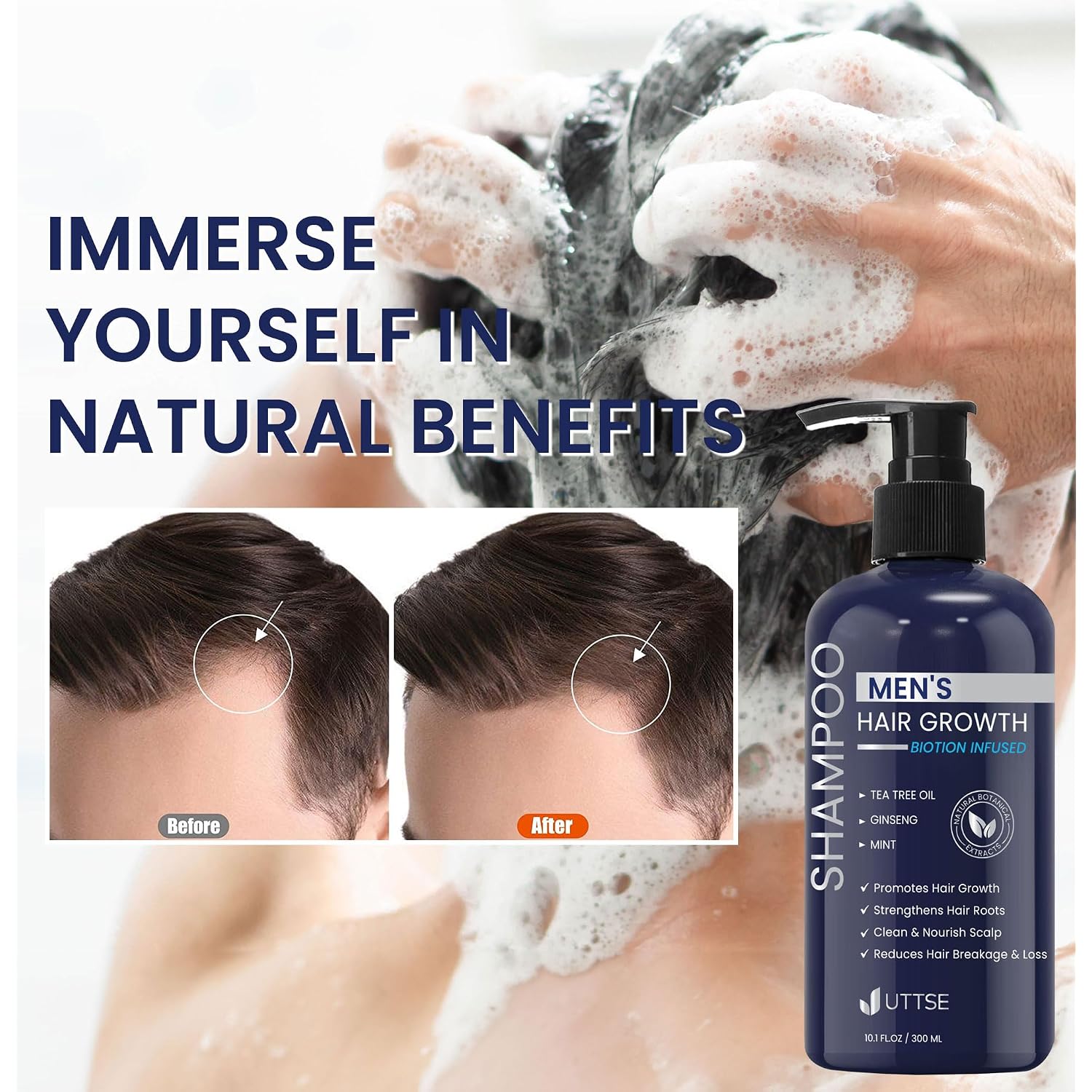 Uttse Biotin Hair Growth Shampoo For Men: Natural Thickening Shampoo With Tea Tree Oil Ginseng Mint For Hair Loss And Thinning Hair - 10.1 Fl.Oz, Dark Blue