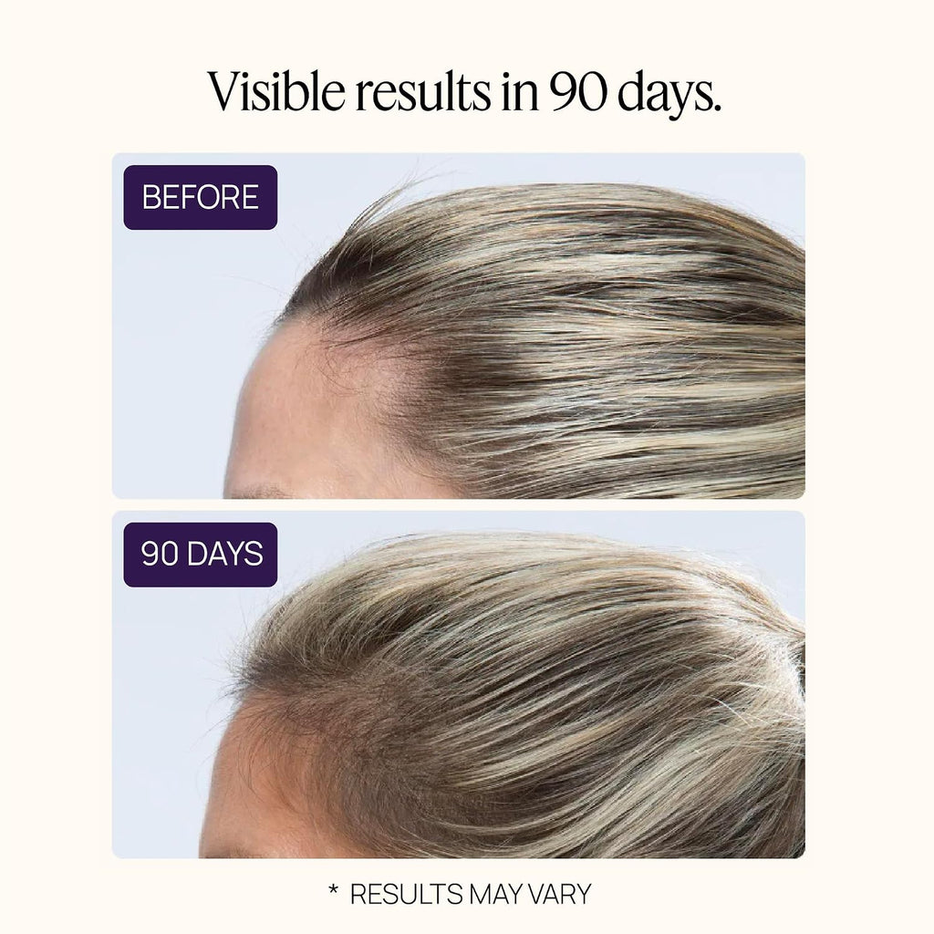 Women'S Hair Growth Peptides, Doctor Recommended, Follicle Fortifying Biotechnology, Clinically Shown To Reduce Hair Loss