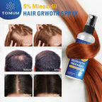 Minoxidil for Men and Women Hair Growth: 5% Minoxidil Topical Spray Hair Regrowth Treatment Stop Hair Thinning and Hair Loss For Stronger Thicker Longer Hair 60ml 2 Pack