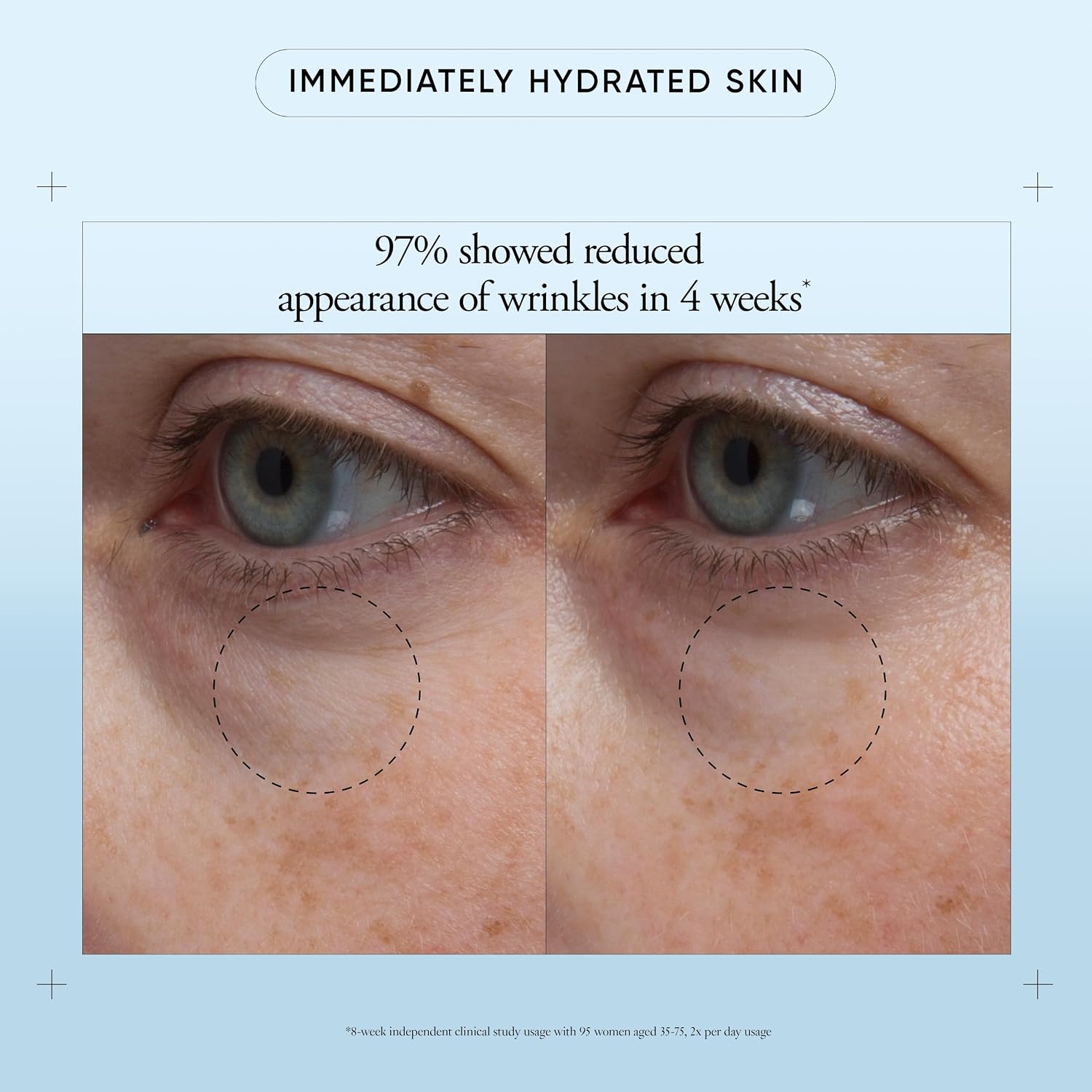 Philosophy Hope In A Jar Eye Revival Serum Eye Cream - With Hyaluronic Acid, Elderberry Extract & Tangerine Peel Extract- Hydrates And Reduces Puffiness - 0.5 Fl Oz