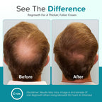 Minoxidil For Men Foam 5% - Unscented 3 Month Supply - Helps Restore Vertex Hair Loss & Thinning - 5% Minoxidil Foam For Men - Extra Strength Supports Hair Regrowth