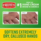 O'Keeffe's Working Hands Intense Renewal Hand Cream with Urea, 3 oz Tube (Pack of 1) – Softens & Smooths Extremely Dry, Callused Hands