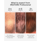 iRestore Professional Laser Red Light Therapy for Hair Growth System - FDA Cleared Hair Loss, Hair Thinning & Alopecia Treatment for Men & Women - 282 Lasers & LEDs
